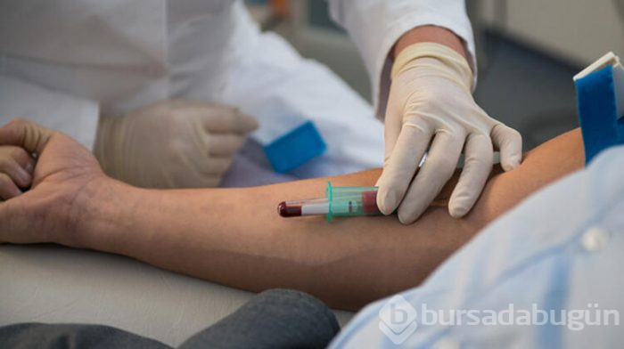 Bağışıklık testi var mı?