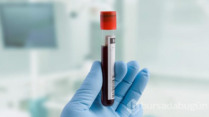 Bağışıklık testi var mı?
