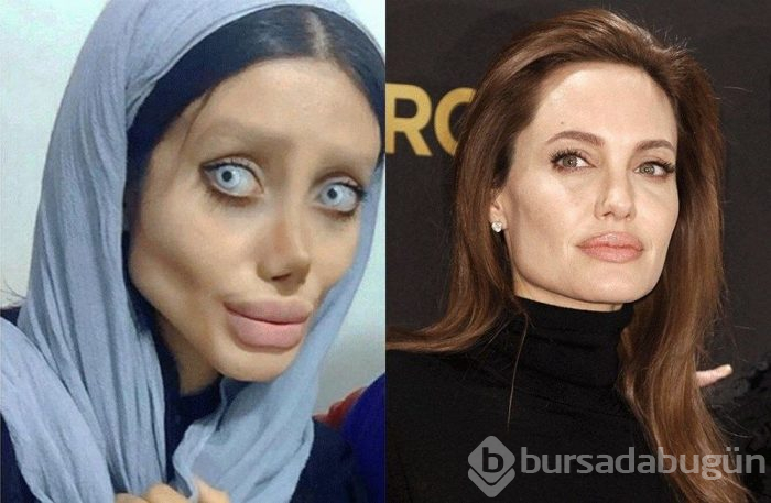 İranlı Angelina Jolie koronaya yakalandı