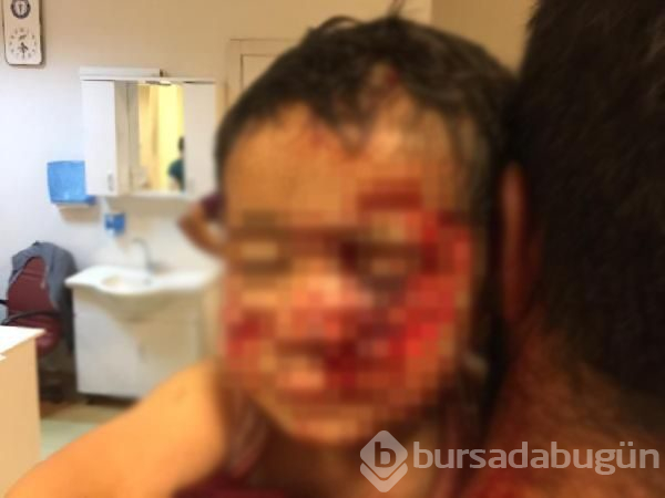 Köpek saldırısına uğrayan küçük Davut, kurtarılamadı
