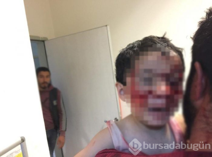 Köpek saldırısına uğrayan küçük Davut, kurtarılamadı