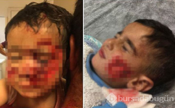 Köpek saldırısına uğrayan küçük Davut, kurtarılamadı