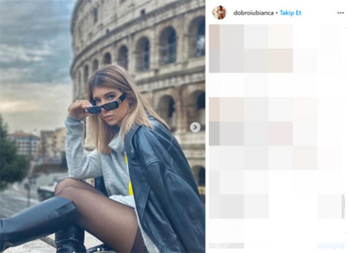 Model Bianca Dobroiu'nun 55 gün sonra yapılan testi yine pozitif çıktı