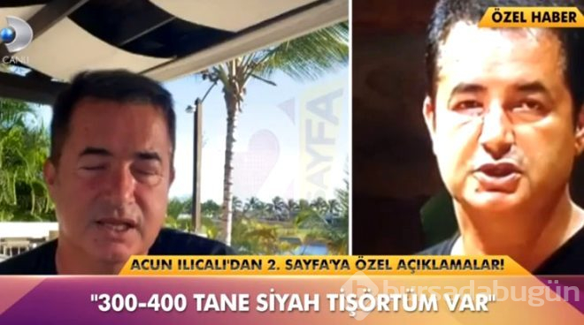 Acun Ilıcalı, 2 yıl önce yüzünde oluşan şişliğin nedenini ilk kez anlattı!