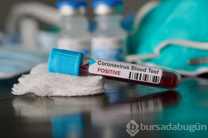 Erkek koronavirüs hastalarına kadınlık hormonu uygulanıyor