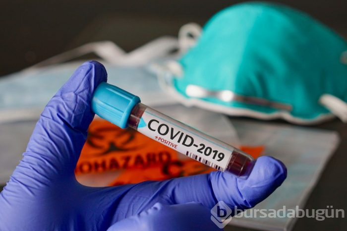 Erkek koronavirüs hastalarına kadınlık hormonu uygulanıyor