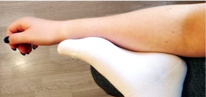 Fotoğraf çektiğimizde  göz bebeklerimiz neden kırmızı çıkıyor? 