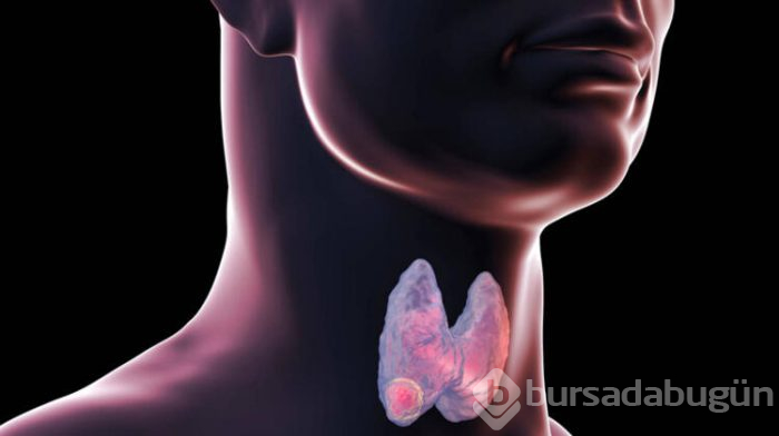 Oruç tutarken tiroit ilaçları nasıl kullanılır?