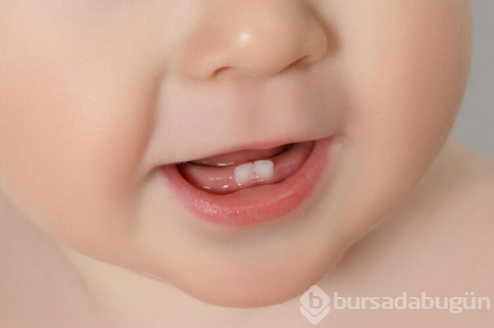 Bebeklerin diş çıkarma döneminde neler yapılmalı? 