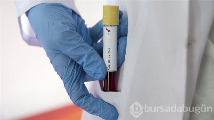 Sağlık Bakanlığı tarafından 150 bin kişiye bağışıklık testi uygulanacak 
