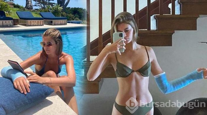 Kaia Gerber'in kolu kırıldı