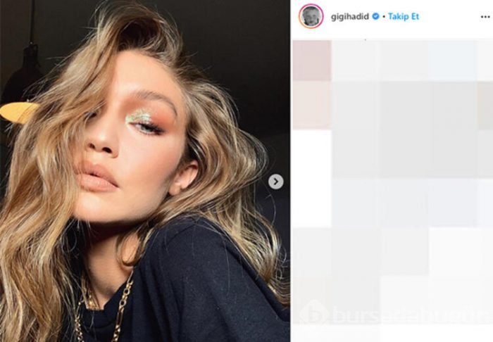 Gigi, estetik iddialarına cevap verdi