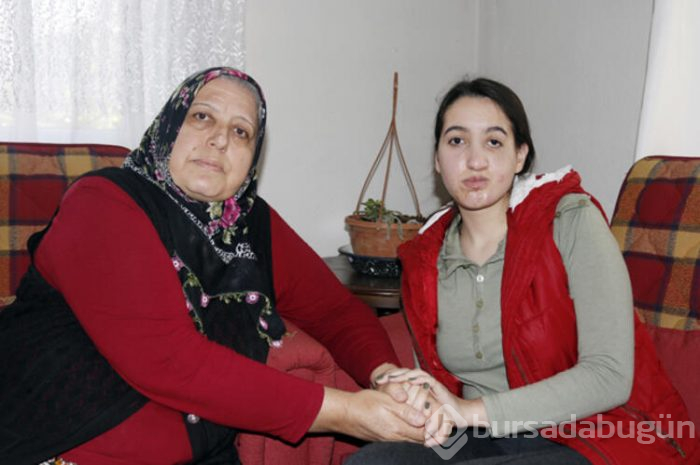 Elmacık kemiği olmadan doğdu! Yüzünün düzelmesini istiyor
