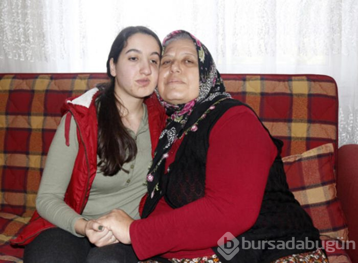 Elmacık kemiği olmadan doğdu! Yüzünün düzelmesini istiyor