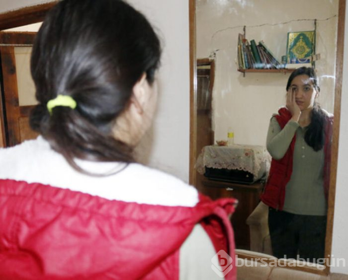 Elmacık kemiği olmadan doğdu! Yüzünün düzelmesini istiyor