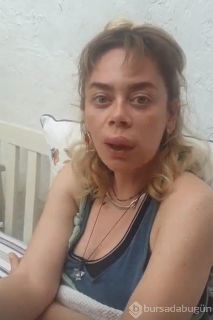 Demet Evgar: Arıların saldırısına uğradı