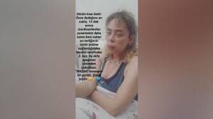 Demet Evgar: Arıların saldırısına uğradı