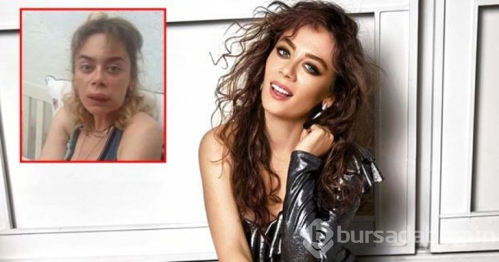 Demet Evgar: Arıların saldırısına uğradı