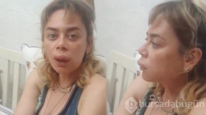 Demet Evgar: Arıların saldırısına uğradı