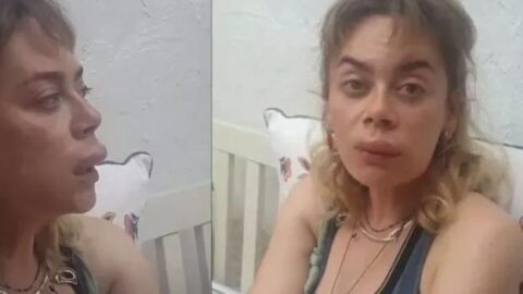 Demet Evgar: Arıların saldırısına uğradı