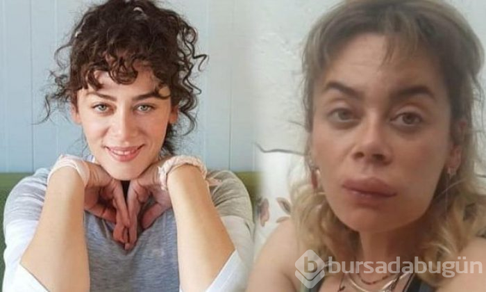 Demet Evgar: Arıların saldırısına uğradı