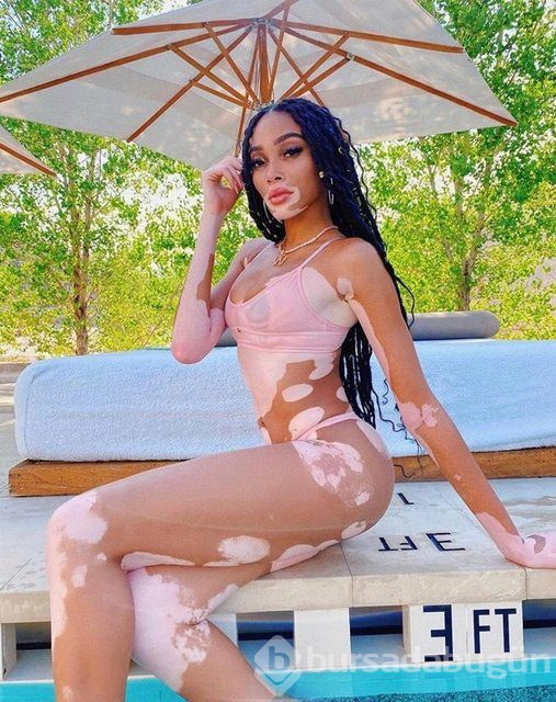 Winnie Harlow karantinadan çıktı