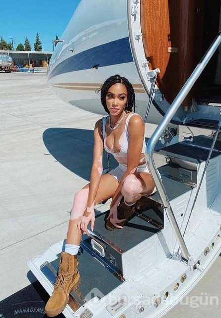 Winnie Harlow karantinadan çıktı