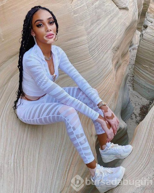 Winnie Harlow karantinadan çıktı