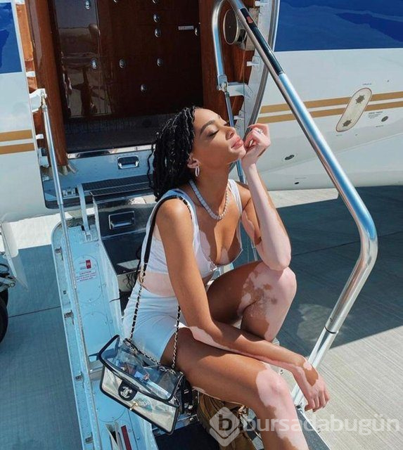 Winnie Harlow karantinadan çıktı