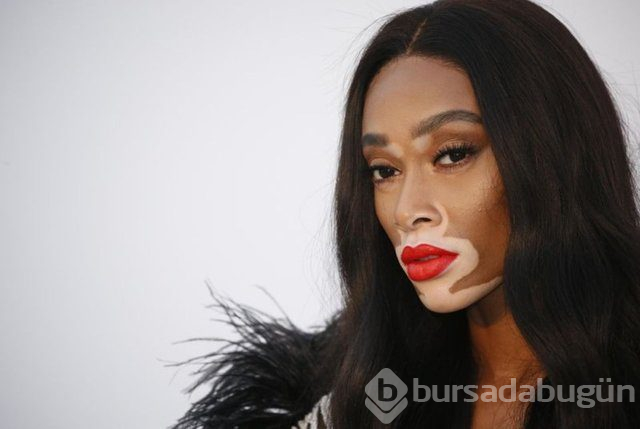 Winnie Harlow karantinadan çıktı