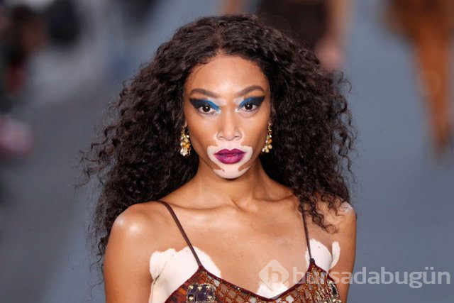 Winnie Harlow karantinadan çıktı