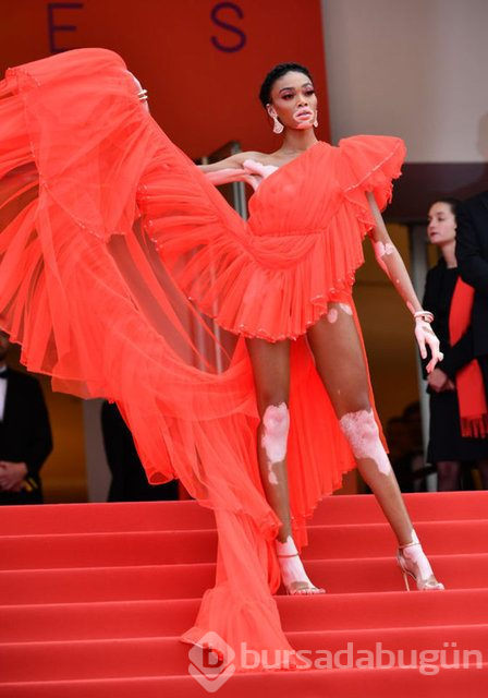 Winnie Harlow karantinadan çıktı