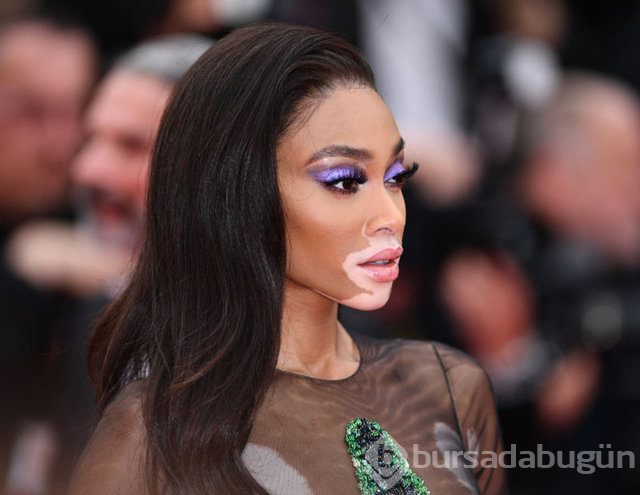Winnie Harlow karantinadan çıktı