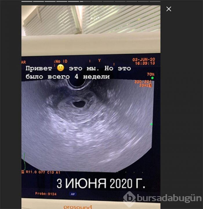 Skandal olay! Üvey oğlundan hamile kaldı