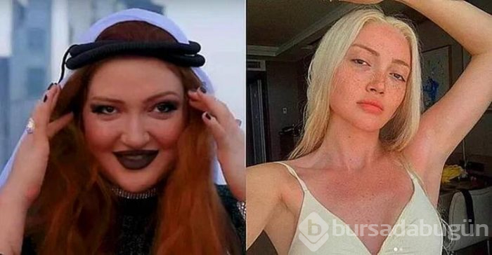 Danla Bilic: 4 kez ameliyat oldum