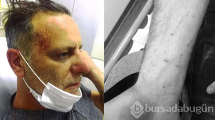 Coşkun Sabah, Ozan Güven Burcu Bulutsuz olayı ile ilgili yorumda bulundu: Kadına el kalkmaz