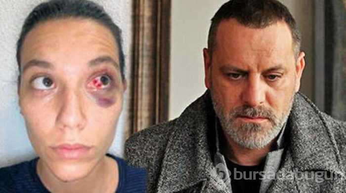 Coşkun Sabah, Ozan Güven Burcu Bulutsuz olayı ile ilgili yorumda bulundu: Kadına el kalkmaz