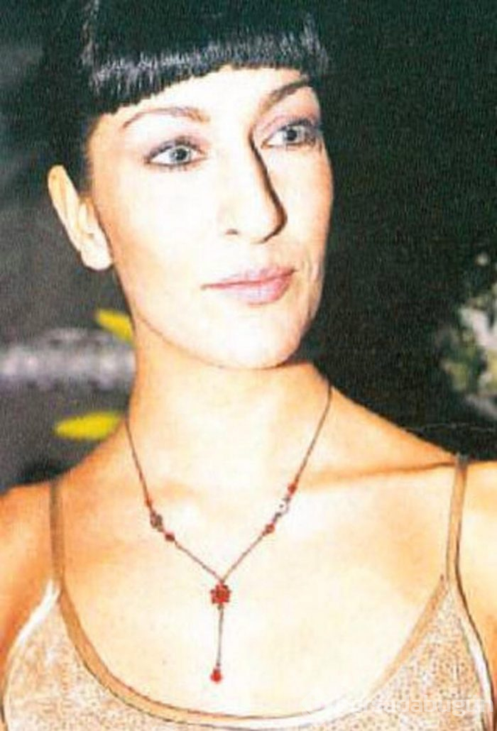 Deniz Akkaya'dan 'estetik' itirafı!