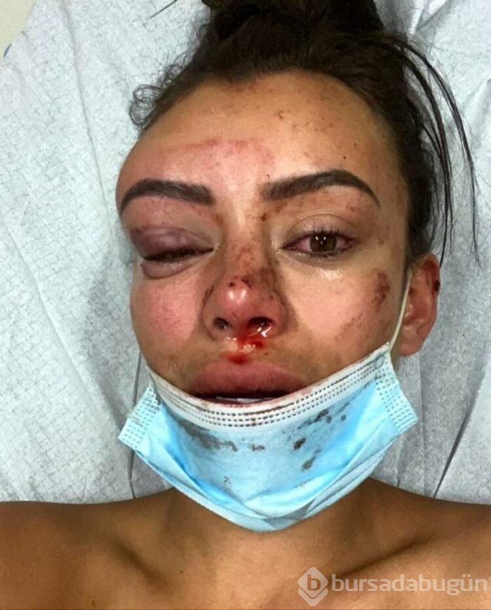 Yasmine Cecilia kendi evinde dehşeti yaşadı