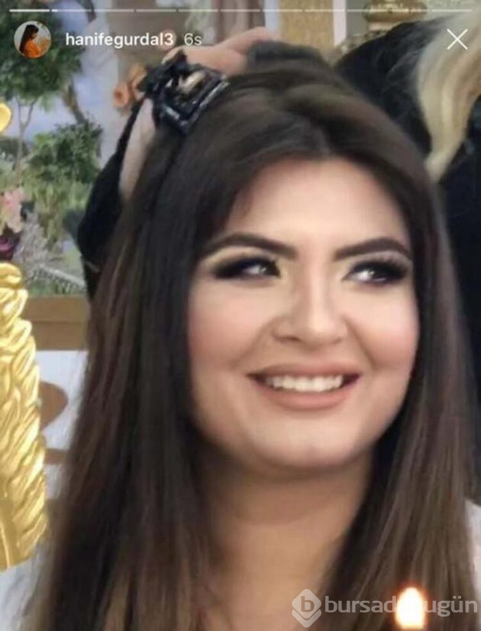 Hanife Gürdal dudaklarına dolgu yaptırdı