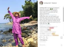 Hanife Gürdal dudaklarına dolgu yaptırdı