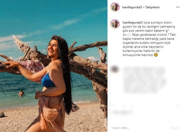 Hanife Gürdal dudaklarına dolgu yaptırdı