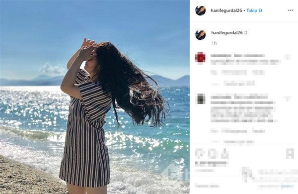 Hanife Gürdal dudaklarına dolgu yaptırdı