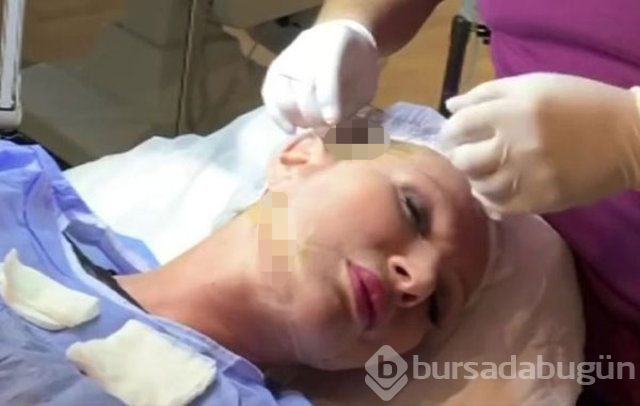 Seda Sayan estetik yaptırırken paylaştı