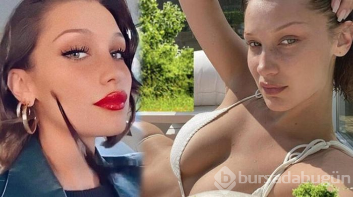 Bella Hadid: 14 yaşımdan beri belirtileri yaşıyorum
