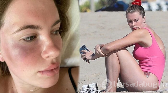 Ireland Baldwin darbedildikten sonra ilk kez görüntülendi
