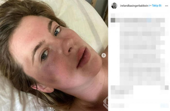Ireland Baldwin darbedildikten sonra ilk kez görüntülendi
