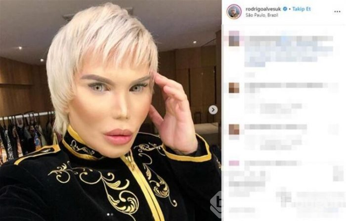 Cinsiyetini değiştirdi Barbie'ye benzemek için 70 estetik ameliyatı geçirdi