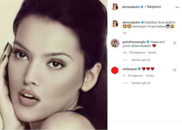 Demet Akalın estetiksiz halini paylaştı! Takipçileri inanamadı
