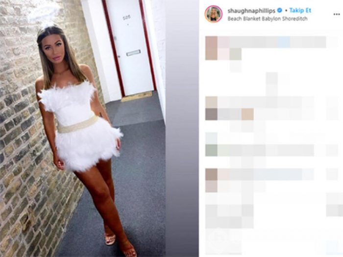 Shaughna Phillips baldırlarından yağ aldırdı